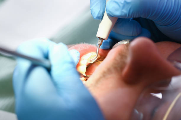 Best Weekend Emergency Dental Services in Marshville, NC