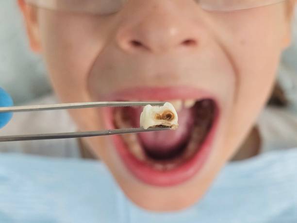 Best Broken or Chipped Tooth Repair in Marshville, NC